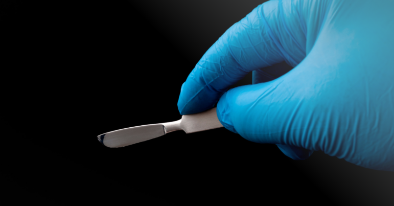 a surgeon's gloved hand holds a scalpel