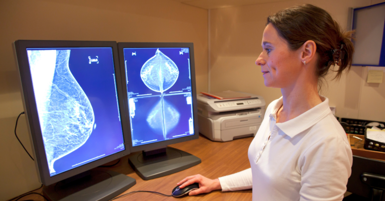 radiology tech looks at mammogram results